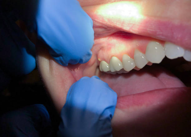 , LA Emergency Dentist Company